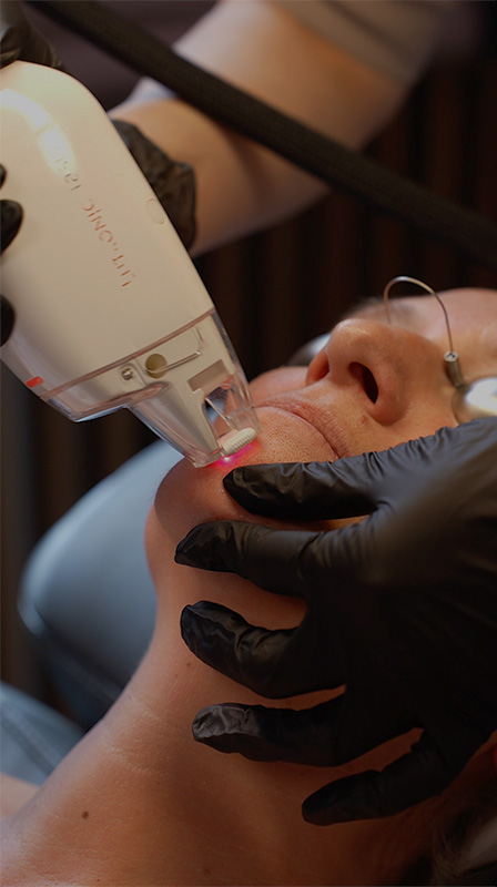 LASER LaseMD – Laser tulowy